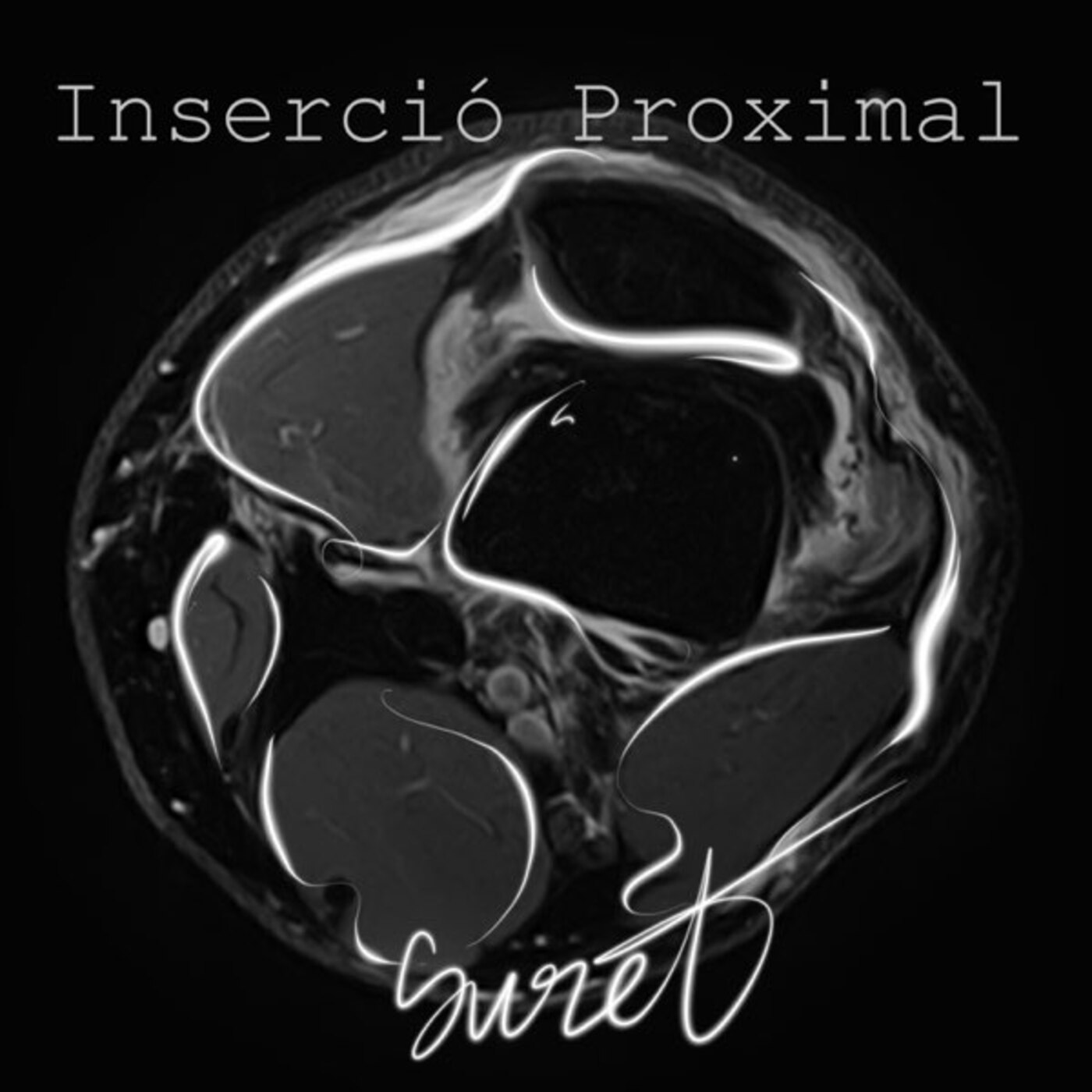 Suret - Inserció Proximal | musica en valencià